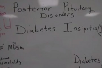 Diabetes Insipidus Statistics